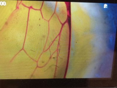 Pozorování vejce pod mikroskopem.